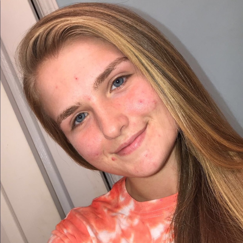 Meet your Posher, Mackenzie